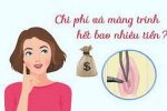 Vá màng trinh bao nhiêu tiền – [UPDATE] Bảng giá mới nhất
