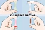 Huyết trắng ra nhiều là bị gì – Giải đáp từ BS CKII Vũ Thị Thanh Dung