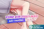 Vùng kín chảy máu bất thường là bị gì – Giải đáp từ bác sĩ CKII