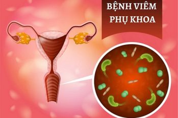 [Chị em nên biết]: Các bệnh viêm nhiễm phụ khoa thường gặp