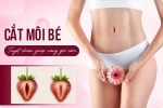 Cắt môi bé là gì? Có đau không? Địa chỉ thẩm mỹ vùng kín TpHCM uy tín