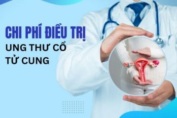 [Chi tiết] Chi phí điều trị ung thư cổ tử cung
