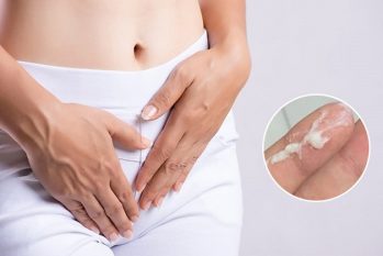 Vùng kín bị ngứa và có dịch cảnh báo bệnh gì ở phụ nữ?