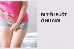 Điểm mặt 6+ nguyên nhân tiểu buốt ở nữ thường gặp