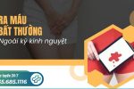 Chảy máu ngoài kỳ kinh có nguy hiểm không?