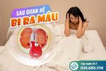 Sau quan hệ bị ra máu: Nguyên nhân và cách xử trí hiệu quả