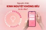 [Điểm mặt 15+] Nguyên nhân kinh nguyệt không đều thường gặp