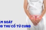 Tầm soát cổ tử cung sớm – Biện pháp bảo vệ sức khỏe nữ giới