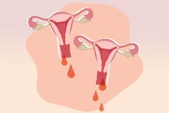 Nguyên Trưởng khoa phụ sản chia sẻ 5 nguyên nhân gây nên chảy máu vùng kín