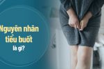 [Tổng quan] tiểu buốt ở nữ giới: Dấu hiệu, nguyên nhân, cách chữa trị