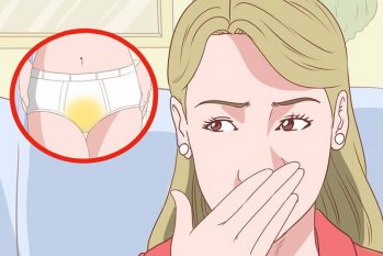 Vùng kín ra dịch màu vàng có mùi hôi là bệnh gì? Cách chữa trị hiệu quả?