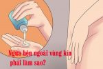 Vùng kín bị ngứa rát bên ngoài: Nguyên nhân + Cách chữa trị