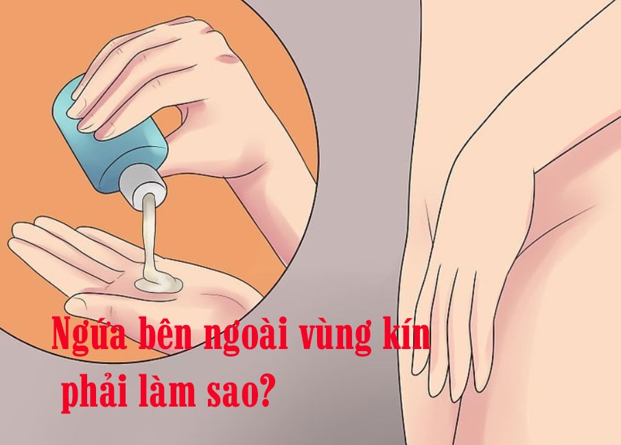 Vùng kín bị ngứa rát bên ngoài: Nguyên nhân + Cách chữa trị
