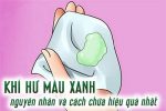 Mách bạn 5+ bệnh lý gây khí hư màu xanh có mùi hôi phổ biến nhất