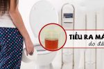 Đi tiểu ra máu là bệnh gì? Chuyên gia chỉ rõ 6 bệnh nguy hiểm cần chú ý