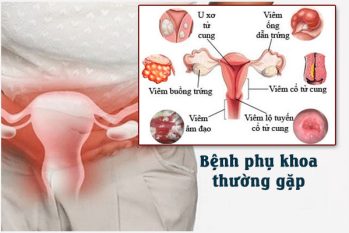 Các bệnh phụ khoa nữ giới thường gặp: Dấu hiệu nhận biết & Cách điều trị hiệu quả