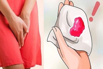 Chảy máu âm đạo bất thường phải làm sao?