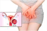 Nguyên nhân gây ngứa âm hộ, ngứa âm đạo thường gặp
