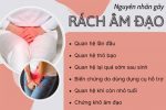 Bị rách âm đạo có nguy hiểm không? Bác sĩ chuyên khoa tư vấn cụ thể