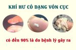 Khí hư vón cục là bị gì? Có nguy hiểm không