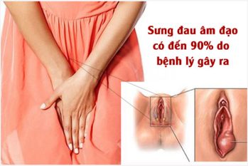 Cảnh giác với hiện tượng đau sưng âm đạo bất thường!