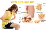 Các cách chữa viêm niệu đạo hiệu quả