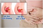 Co thắt âm đạo: Nguyên nhân, cách khắc phục hiệu quả
