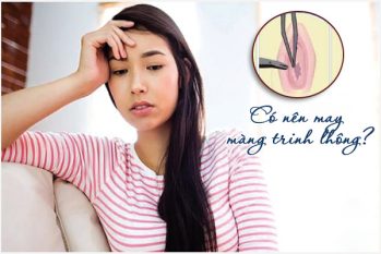 Có nên may màng trinh không? Địa chỉ may màng trinh uy tín và thẩm mỹ