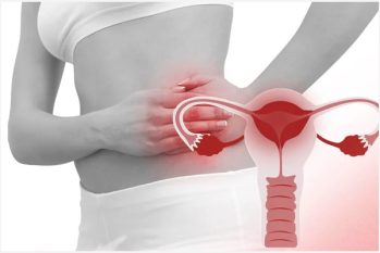 Viêm vùng chậu là bệnh gì? Nguyên nhân, Triệu chứng và Cách khắc phục hiệu quả